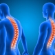 Spinal male illustration